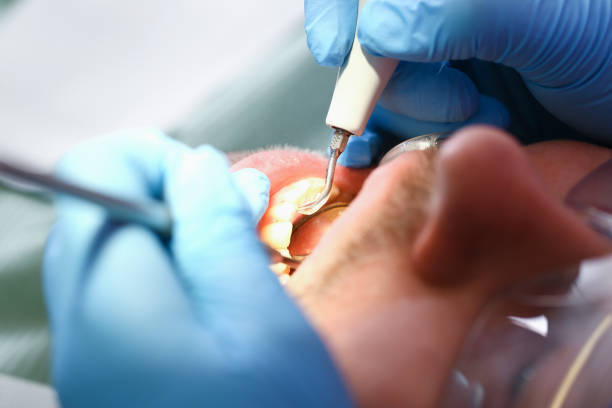 Best Emergency Tooth Extraction  in Montgomery, GA